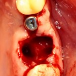 0_e8c0a_36b90d0a_L[1]