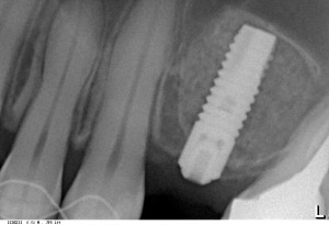 Чр_Т_20140215_8856