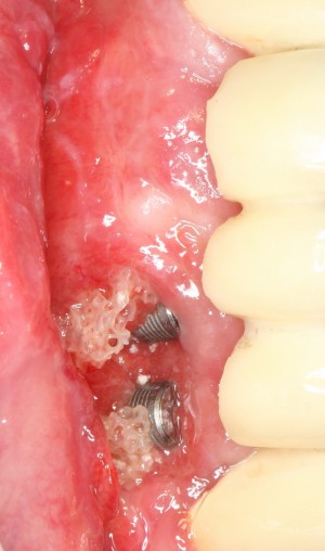 Исходная клиническая ситуация