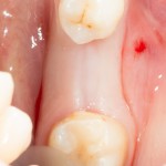 исходная клиническая ситуация