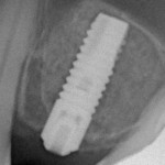 Чр_Т_20140215_8856 (1)