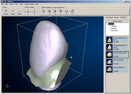 «Искусственная кость» — мифы и реальность.