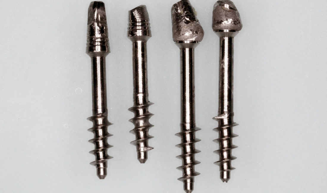 Базальная имплантация, как&nbsp;она&nbsp;есть.