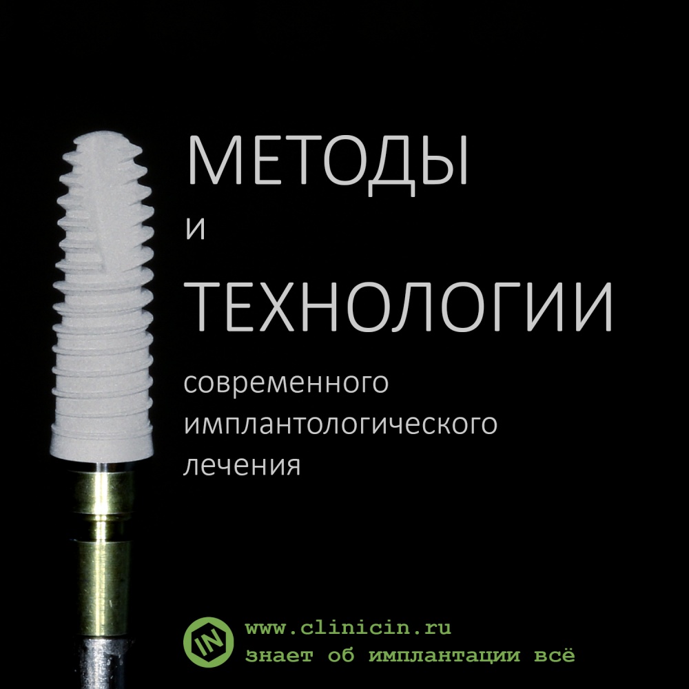МЕТОДЫ и ТЕХНОЛОГИИ современного имплантологического лечения
