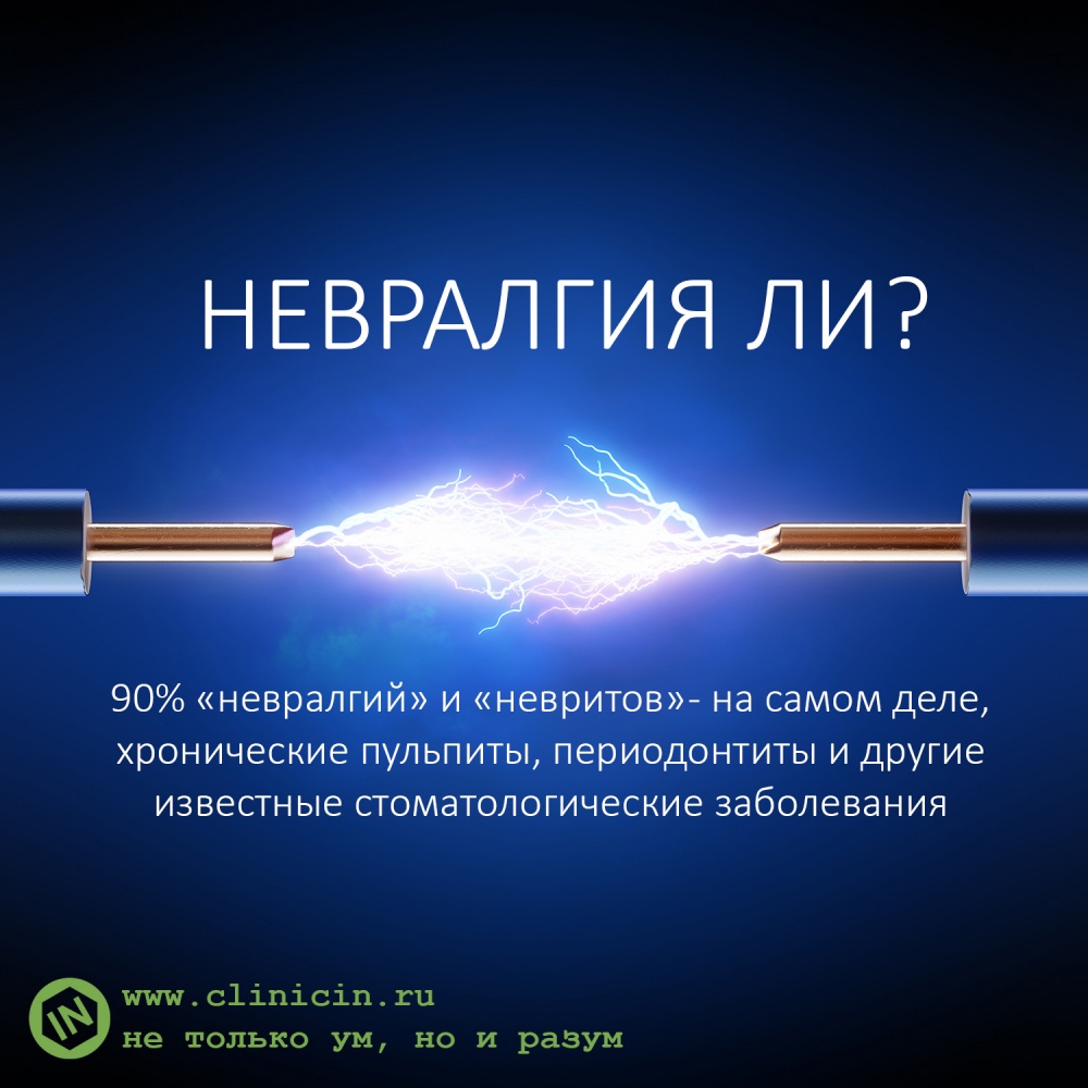 Невралгия ли?