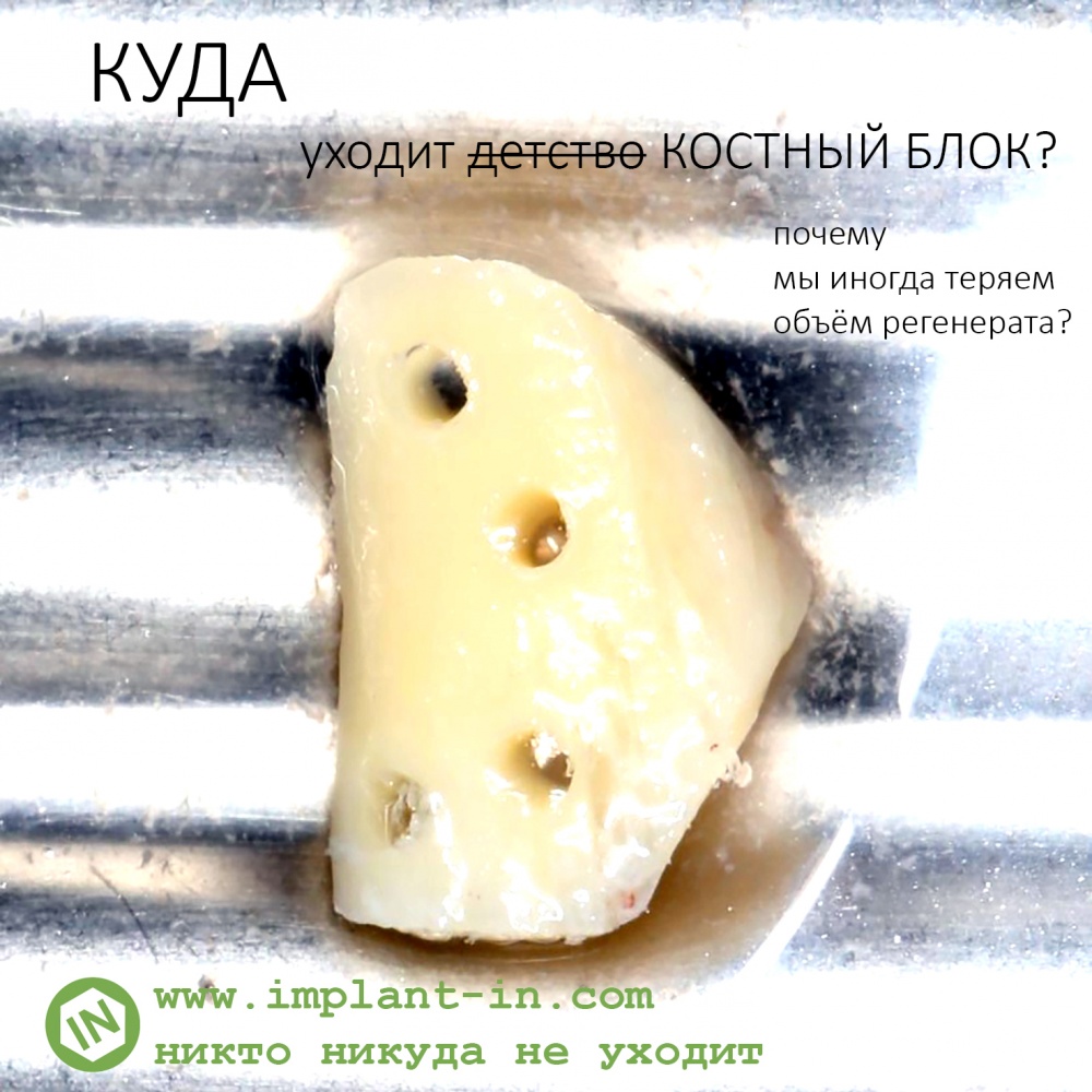 Куда уходит костный блок?