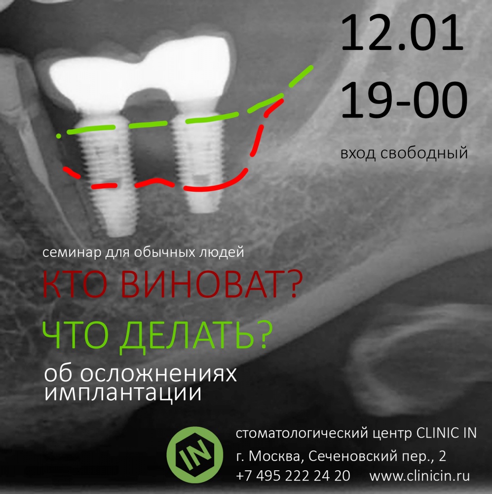 Кто виноват? Что делать? Об осложнениях имплантации.
