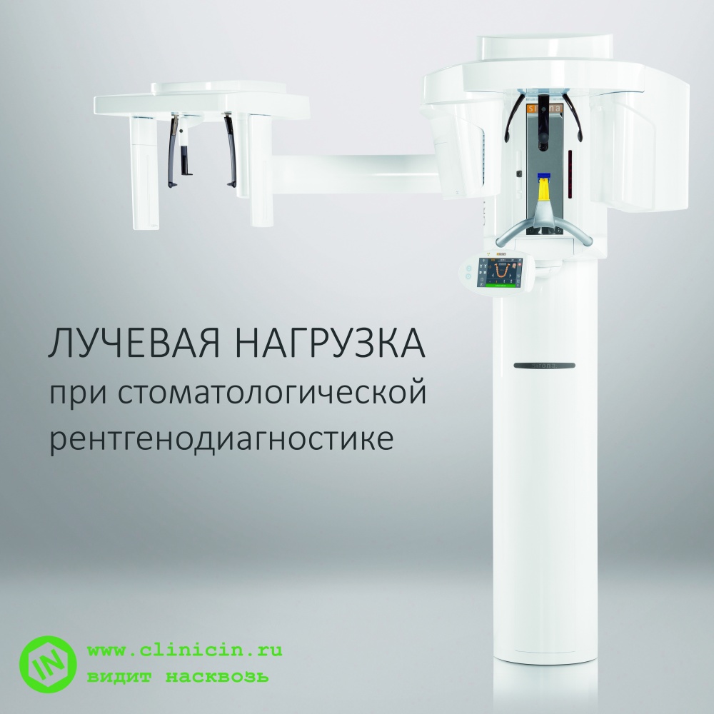 Лучевая нагрузка при стоматологической рентгенодиагностике