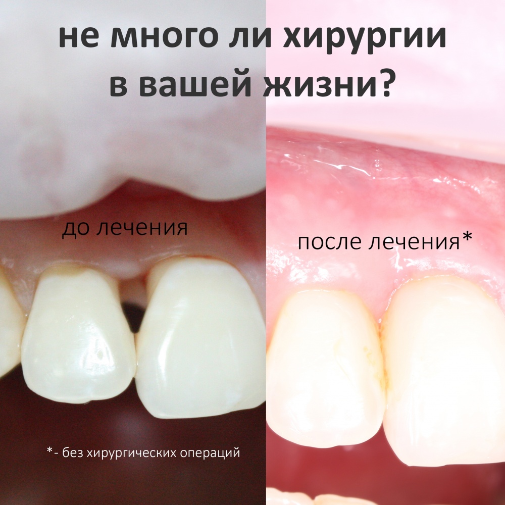 Не многовато ли хирургии в вашей жизни?