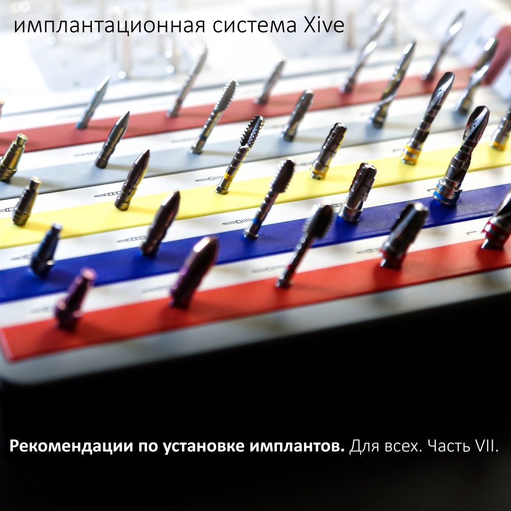 Рекомендации по установке имплантатов. Часть VII. XiVE.