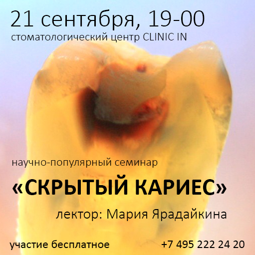 21 сентября, 19-00. Семинар «Скрытый кариес» от Марии Ярадайкиной. Welcome!