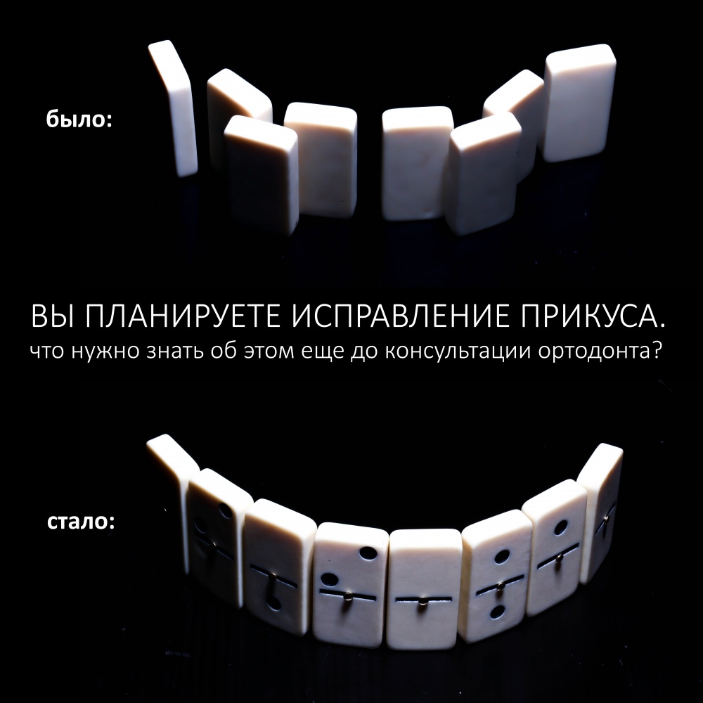 Вы планируете исправление прикуса — что нужно знать об этом еще до консультации ортодонта?
