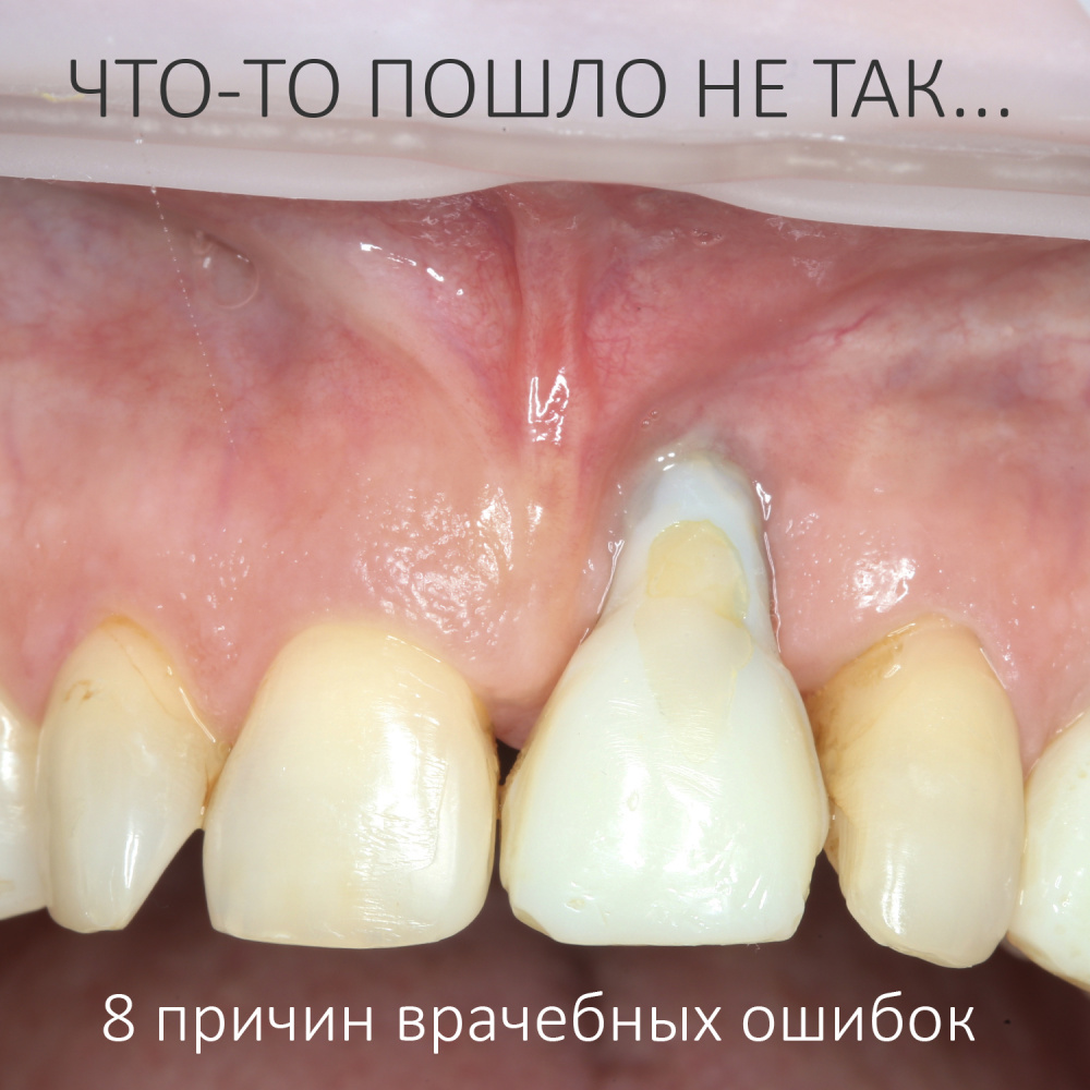 ЧТО-ТО ПОШЛО НЕ ТАК — восемь ключевых причин врачебных ошибок